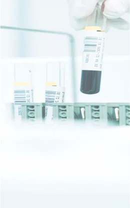 液相色谱在工领域的应用